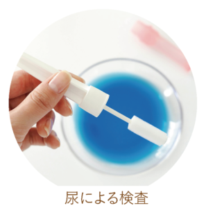 じんにゃんチェック尿検査