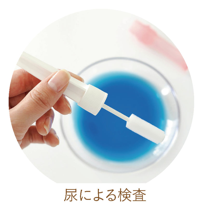 じんにゃんチェック尿検査